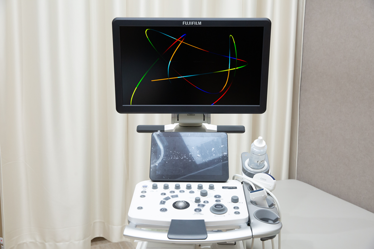 超音波診断装置